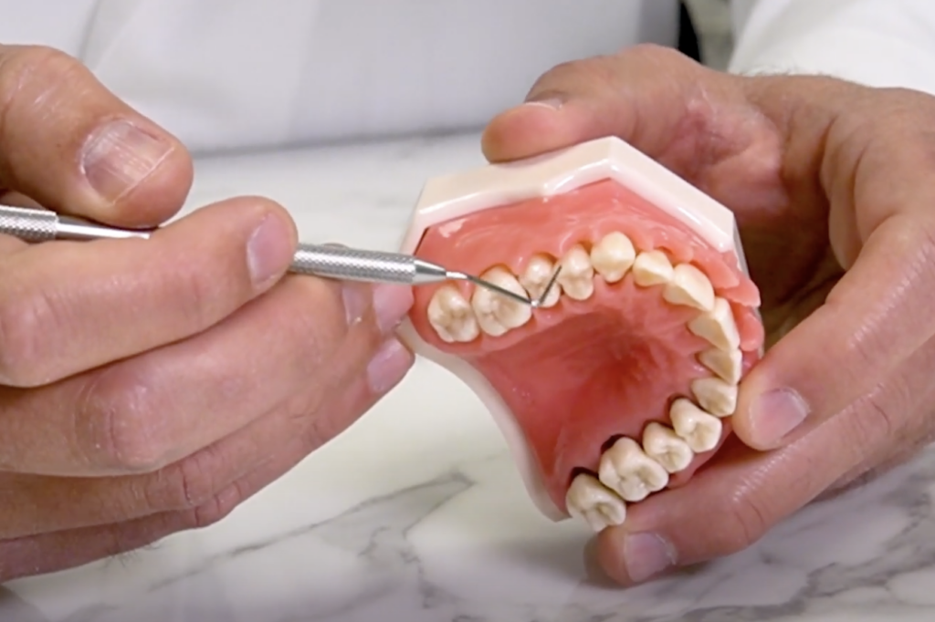 What Causes Periodontal Disease | Village Periodontics